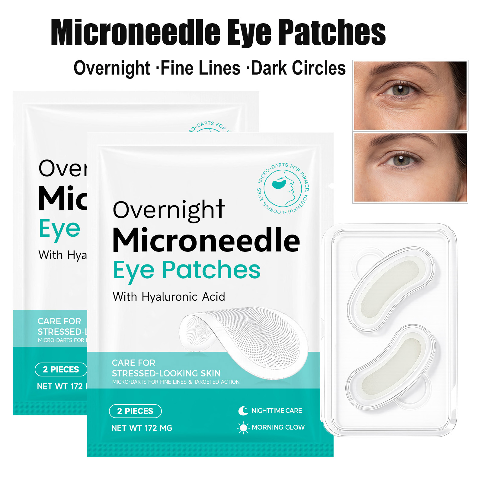 Microneedle Patch Eye - Микронидли-патчи для глаз с гиалуроновой кислотой